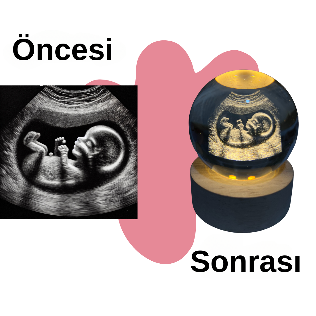 Ultrason Lambası